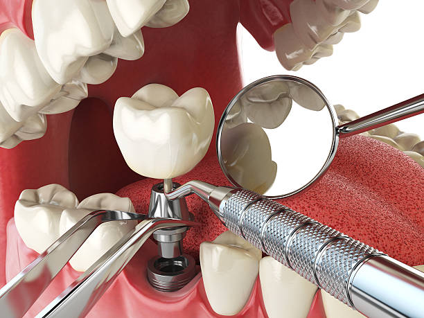 Best Cosmetic Emergency Dentistry in Akron, PA